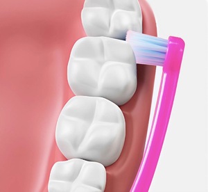 Juego de cepillos interdentales de ortodoncia para el cuidado de aparatos ortodóncicos - <span class=keywords><strong>Cepillo</strong></span> <span class=keywords><strong>interproximal</strong></span> de cerdas suaves para la limpieza de los <span class=keywords><strong>dientes</strong></span> y la salud de las encías - Product Image 2