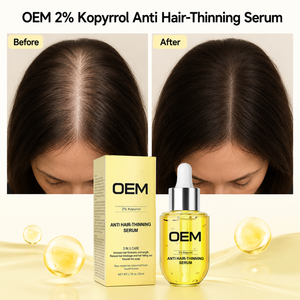 Suero para el Cabello OEM para Densificar el Cabello y Fortalecer el Cuero Cabelludo, 50 ml, con 2% de Kopyrrol, Extracto de Jengibre, Queratina y Biotina para Raíces Débiles y Cabello Fino, Suministro al por Mayor - Product Image 6