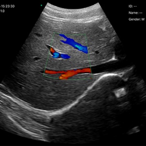 Sonde échographique linéaire sans fil mini CU13-R à double fréquence 10 et 14 MHz, pour ponction avec kit de guidage, Doppler couleur, 128 éléments - Product Image 5