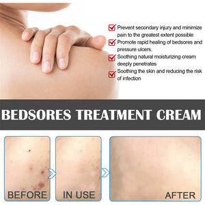 EELHOE 20g Bedsores bakım kremi Sore giderici bacak bulantı enfekte yara iyileşmesi Bedsore pressurecream kaldırma kremi - Product Image 3