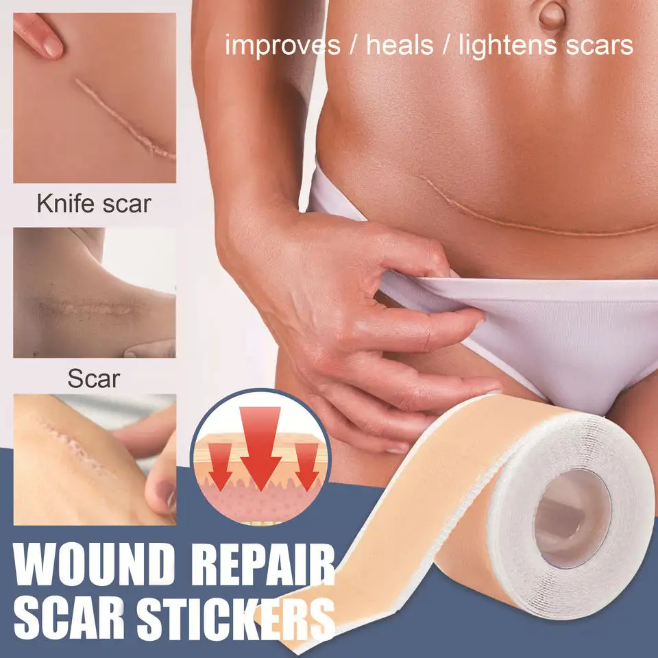 best seller silicon gel tape sheet for old scars on legs scar removal patch