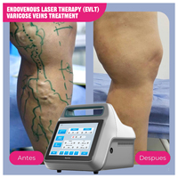 Appareil de traitement des varices des jambes par laser endoveineux (EVLT) 980nm+1470nm pour l'élimination des varices