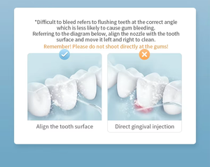 Hydropulseur dentaire sans fil, irrigateur buccal, 3 modes de pression, nettoyeur de dents portable pour l'entretien des appareils dentaires - Product Image 2