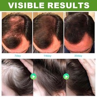 Shampoo à l'huile de romarin naturel Batana pour lutter contre la perte de cheveux, stimuler la croissance et épaissir les cheveux