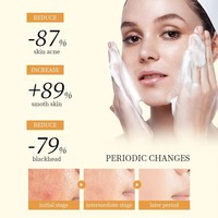Produits de soin de la peau, soin du visage, nettoyage en profondeur, nettoyant visage, traitement de l'acné, mousse nettoyante pour le visage avec de l'eau pour tous les types de peau