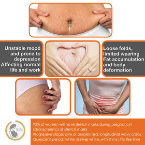 Venta al por mayor cuerpo piel calmante y suavizante sequedad y arrugas reducción estiramiento eliminación masaje crema - Product Image 3