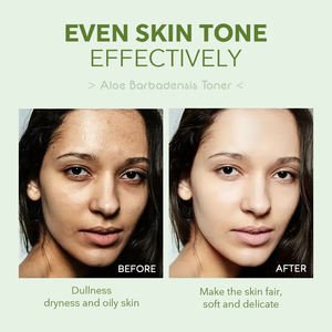 Dropshipping Label pribadi lidah buaya Korea, Toner perawatan kulit menenangkan menyegarkan air lidah buaya menenangkan grosir Toner kulit - Product Image 2