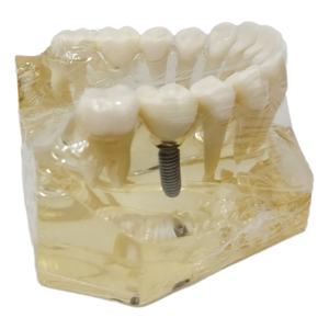 علوم طبية دراسة طبيب الأسنان موارد تعليمية إلكترونية محاكاة عالية الجودة راتنج زرع الأسنان الفك السفلي - Product Image 5