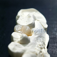 Bloque de Zirconia Multicapa Ivista UT-ML, Económico, 60% de Translucidez, 650 MPa, para la Fabricación de Prótesis Fijas