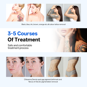 Máquina de Belleza para Eliminación de Tatuajes con Láser de Picosegundos Comercial de 2000W, Tecnología Multi-Largo de Onda, Eliminación de Pigmentos, Suministro de Fábrica - Product Image 4