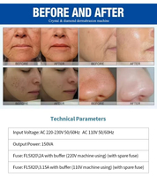 Prix d'usine, dermabrasion, soin de la peau en soie, microdermabrasion au diamant, nettoyage en profondeur et resserrement de la peau