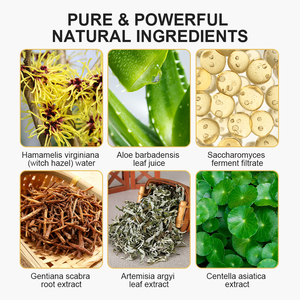 <span class=keywords><strong>Agua</strong></span> nutritiva y calmante OEM/ODM para todo tipo de piel con Centella y manzanilla calma el enrojecimiento y fortalece la barrera - Product Image 4