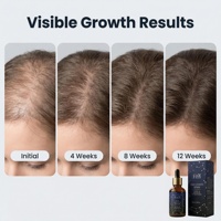 Sérum de croissance capillaire Redensyl Biotine Romarin Peptide pour des cheveux plus épais et plus volumineux, sans prostaglandine, OEM, marque privée, vente en gros