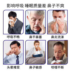 Rinite allergica unguento per sinusite nasale comune <span class=keywords><strong>raffreddore</strong></span> congestione nasale starnutire prurito naso - Product Image 3