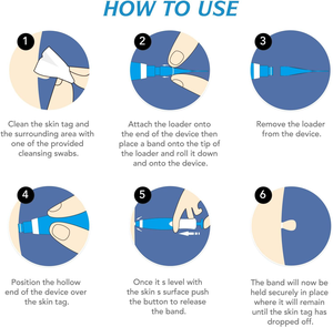 Safety 2 in 1 <strong>Skin</strong> <strong>Tag</strong> <strong>Removal</strong> Kit <strong>Skin</strong> Mole Wart Remover 2mm to 8mm <strong>Skin</strong> <strong>Tag</strong> Remover Pen With Cleansing Swabs and Repair <strong>Patch</strong> - Product Image 4