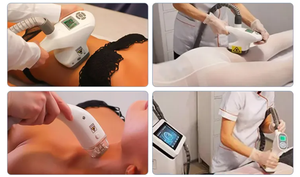 Máquina Profesional de Drenaje Linfático y Adelgazamiento Corporal con Rodillo de Vacío Vela Boby para Masaje Facial y de Cuello, Quema Grasa - Product Image 5