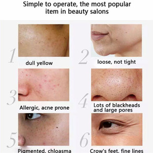 S OEM/ODM 85% Spongilla <span class=keywords><strong>Bio</strong></span> Microneedling Kit Terapi Pembaruan Kulit dengan Mikroneedling Biologis & Spikula Spons untuk Salon dan Rumah - Product Image 3