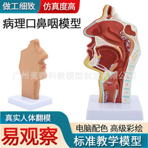 Modelo anatómico patológico de la cavidad nasal; modelo de enseñanza de otorrinolaringología; cavidad nasal; nariz; modelo de estructura oral-nasal - Product Image 5
