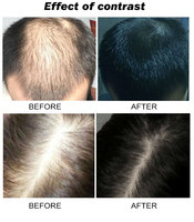 Shampooing Gel Bio Maxipro au Ginseng Chinois Anti-Chute Anti-Pelliculaire Nourrissant Lissant Épaississant 2-en-1 aux Fleurs
