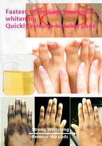 Cosmético para Manos y Piernas, Suero Blanqueador para Nudillos Oscuros para Piel <span class=keywords><strong>Negra</strong></span>, Suministrado por Fabricante de Cosméticos - Product Image 2