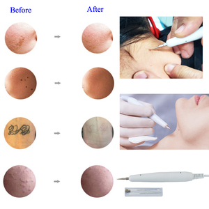 AU-8208 xách tay 8 trong 1 tần số cao Galvanic máy trên khuôn mặt Beauty Salon Thiết bị hút chân không loại bỏ tag thiết bị - Product Image 6