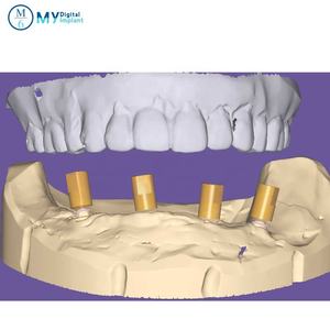 Scanbody dentale M6 compatibile con impianto alphbio CE - Product Image 2