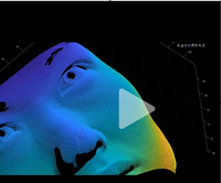 Escáneres 3D Infrarrojos 2-2 con Precisión de 0.05 mm; Optimizados para Estética Digital Médica; 4. Seguro para escaneos faciales prolongados