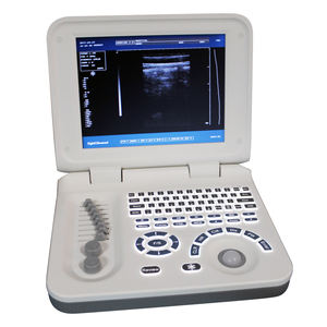 Scanner portatif d'ultrason avec l'imagerie à haute résolution, conception légère pour le diagnostic médical - Product Image 3