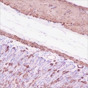 Anticuerpo Monoclonal de Actina Muscular Lisa Alfa Recombinante - Product Image 4