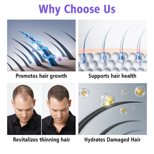 <span class=keywords><strong>Shampooing</strong></span> Clarifiant Doux Hydratant <span class=keywords><strong>Anti</strong></span>-Chute <span class=keywords><strong>et</strong></span> <span class=keywords><strong>Anti</strong></span>-Pelliculaire Joynna à la Cerise pour Cheveux Bouclés <span class=keywords><strong>et</strong></span> Croissance Capillaire - Formule Dubaï - Product Image 2