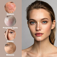 Crème Visage Anti-Taches Nourrissante en Profondeur et Unifiante pour le Teint, à la Céramique, pour Tous Types de Peau