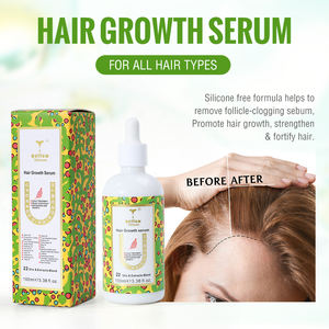 Suero para el Crecimiento del Cabello con Biotina de Marca Privada Personalizada, Suero Reparador de Queratina, Aceite para el Recrecimiento del Cabello de 30 ml, Suero Anticaída para Hombres y Mujeres - Product Image 3