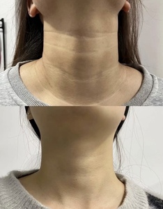 KXY Derma Ampolla Rassodante Collo Effetto Lifting Anti-Età Collagene Idratante - Product Image 3