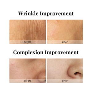 Siero al Retinolo con Etichetta Privata Anti-Età, Rassodante e Idratante per il Viso - Product Image 2