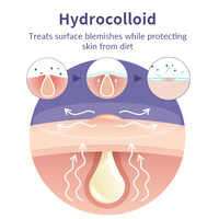 Patchs anti-boutons coréens hydrocolloïdes, autocollants pour l'acné, traitement esthétique mignon et rond pour le visage, marque privée OEM