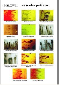 Microscope de contrôle de <span class=keywords><strong>Microcirculation</strong></span> capillaire biologique numérique pour <span class=keywords><strong>Test</strong></span> sanguin - Product Image 6