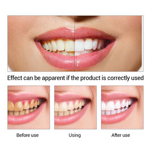 Kit de blanchiment des dents aux ingrédients naturels <span class=keywords><strong>pour</strong></span> soins quotidiens, effet blanchissant exceptionnel <span class=keywords><strong>pour</strong></span> les consommateurs de thé/café, protège efficacement les gencives - Product Image 4