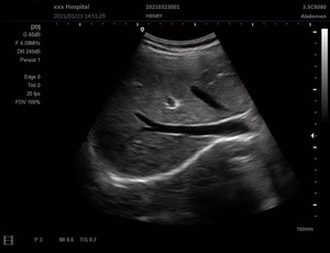 Portable <strong>Ultrasound</strong> <strong>Scanner</strong> For Medical Diagnostic Imaging Center Using Equipment <strong>Ultrasound</strong> Machine Vet Or Human - Product Image 4