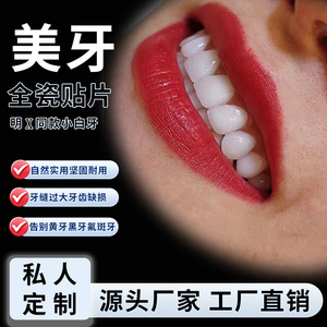 Carillas de Porcelana Lingxi Blancas Naturales de Simulación para Blanqueamiento y Restauración Dental, Uso en Adultos - Product Image 2