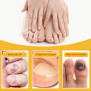 2025 Popular Método de uso simple Recuperación rápida de la salud de las uñas Crema reparadora de uñas dañadas - Product Image 5