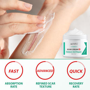 Crème personnalisée anti-acné et vergetures pour le visage et le corps, réparatrice des taches de rousseur et des cicatrices (chirurgie, blessures, brûlures, anciennes cicatrices) - Product Image 4