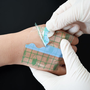 Roll Plester Medis Transparan PU Tahan Air Bernapas EOS Stiker Tato Sementara Perekat Berkualitas Bersertifikat CE - Product Image 6