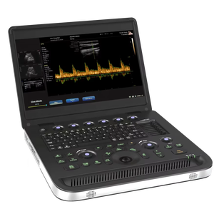 Sistema <span class=keywords><strong>de</strong></span> Diagnóstico por Ultrasonido Doppler Color 3D 4D <span class=keywords><strong>de</strong></span> Bajo Costo, Equipo <span class=keywords><strong>de</strong></span> Ultrasonido Portátil a Color con Función PW CW - Product Image 1