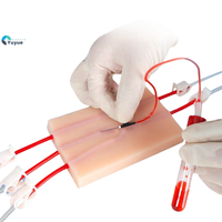 Estudiantes de medicina, enfermeras, modelo de entrenamiento, tubo en Y, almohadilla de práctica de inyección intravenosa, módulo de silicona de grado alimenticio, simulación de sangre