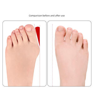 สายรัดยืดหัวแม่เท้าแบบพกพา ใช้ซ้ำได้ สำหรับแก้ไขปัญหาหัวแม่<span class=keywords><strong>เท้า</strong></span>เก/<span class=keywords><strong>นิ้ว</strong></span><span class=keywords><strong>โป้ง</strong></span><span class=keywords><strong>เท้า</strong></span>โก่ง - Product Image 5