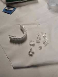 Pasta di Zirconia per Modelli Dentali, Denti Stampati in 3D, Corone Dentali Dopo Disincrostazione e Sinterizzazione - Product Image 6