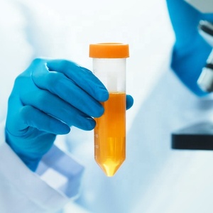 Laboratorio desechable cónico estéril 15mL 50mL centrífuga Falcon tubos con graduación clara - Product Image 3