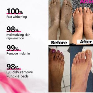 Sérum éclaircissant rapide Correcteur de pigmentation foncée <span class=keywords><strong>Taches</strong></span> de peau noire Essence éclaircissante et anti-<span class=keywords><strong>taches</strong></span> à la niacinamide <span class=keywords><strong>pour</strong></span> le <span class=keywords><strong>visage</strong></span> - Product Image 3