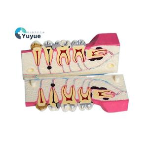 Modelo de Descomposición de Tejido de la Mandíbula Inferior Derecha |   Modelo de Anatomía del Diente del Sabiduría para Entrenamiento, Educación y Exámenes en Clínicas Dentales - Product Image 1