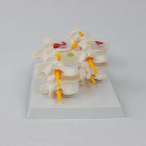 Modelo de degeneración de vértebras lumbares de 4 etapas de ciencia médica modelo de columna vertebral humana modelo de disco intervertebral Lumbar - Product Image 4